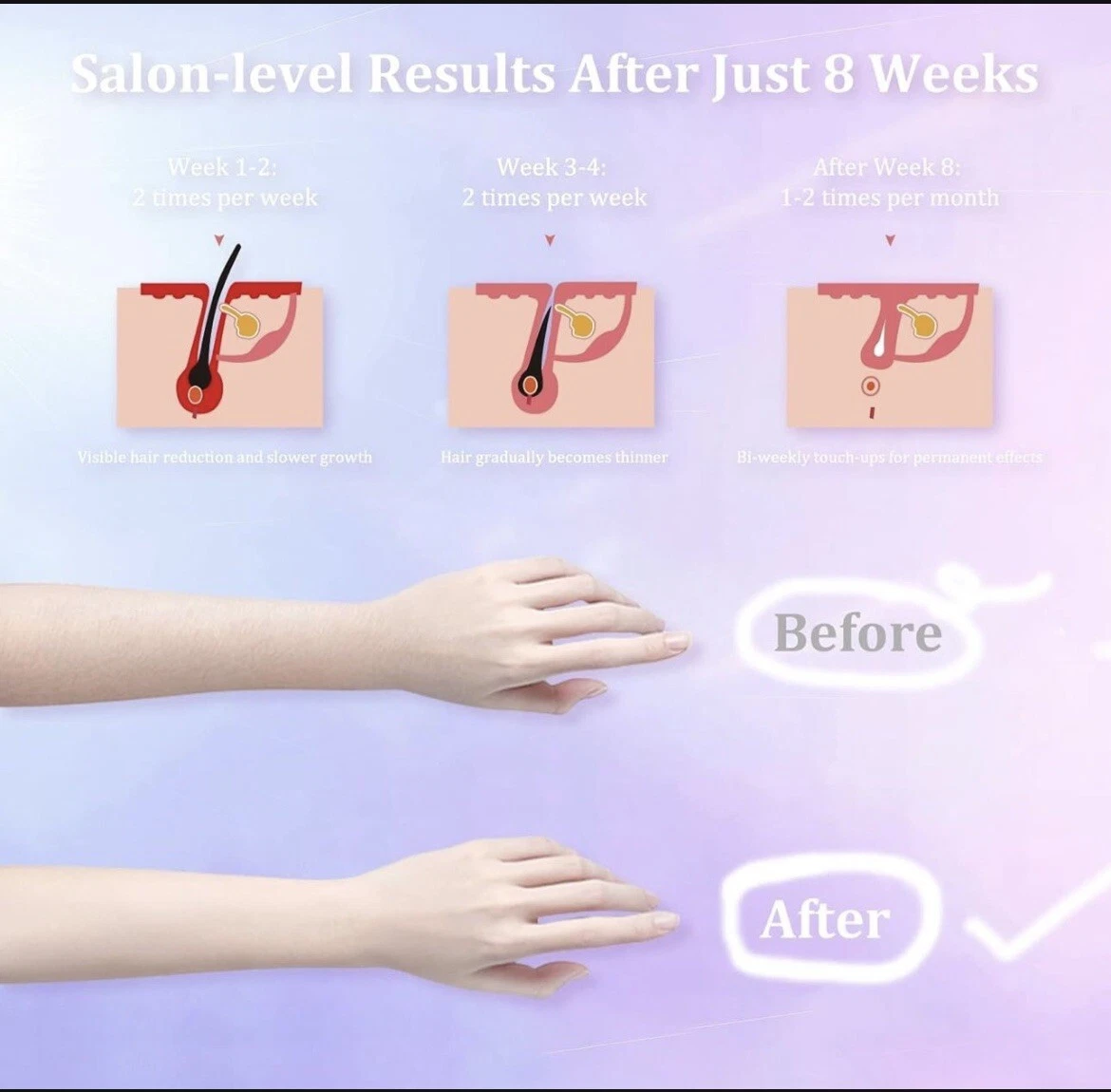 Necool IPL Hair Removal - Image 3